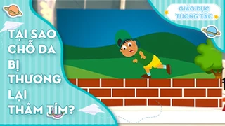 Tại sao chỗ da bị thương lại thâm tím?